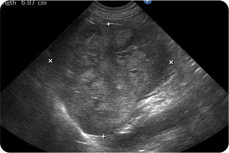 3‐a　イヌの外側左葉の肝細胞癌(超音波検査)