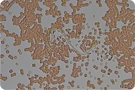 1-ｂ　血液中の犬糸状虫ミクロフィラリア
